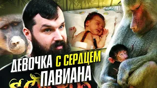 Пересадка сердца павиана? Трагическая история Бэби Фэй