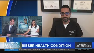 Expert explains Ramsay Hunt Syndrome, which Justin Bieber suffers from