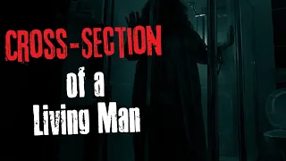 "Cross Section of a Living Man" Creepypasta Scary Story