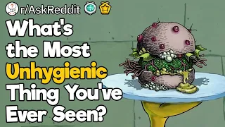 What's The Most Unhygienic Thing You've Ever Seen?
