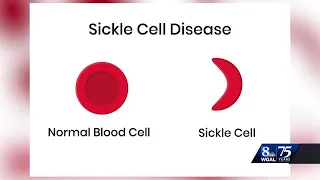 What is sickle cell disease, the illness that led to a teen's death?