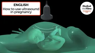 How to use ultrasound in pregnancy