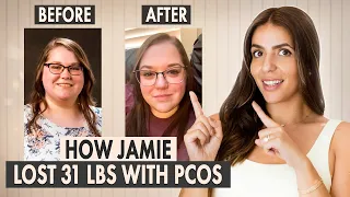 How Jamie Lost 31 Pounds with PCOS | Learn Her Method!