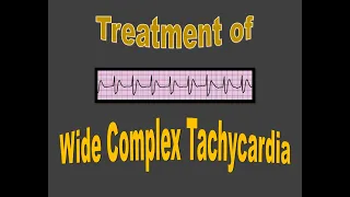 Cardiac emergencies - treating wide-complex tachycardia