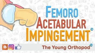 Femoroacetabular Impingement (FAI) | ANIMATION | BASICS | Femur Anatomy - The Young Orthopod