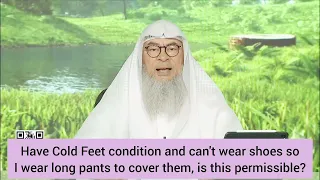 Cold feet, can't wear shoes, can I wear pants below my ankles to cover feet? #Assim assim al hakeem