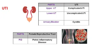 GI infections, urinary track infections and skin and soft tissue infections