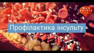 Профілактика інсульту: Розбір клінічних випадків в практиці невролога. Ревенько І.Л.