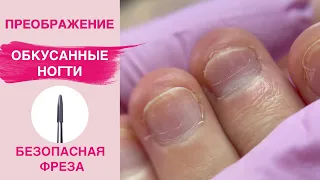 Наращивание ногтей на обкусанные ногти | Маникюр безопасная фреза