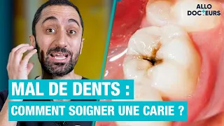 🦷 Comment soigner une CARIE ? Les réponses du Dr Jimmy Mohamed