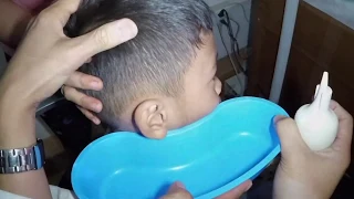 Foreign Body Got Stuck in Boy's Ear- Is It An Earwax or Not?