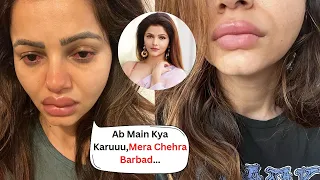 Rubina Dilaik Crying Badly After Lip Surgery Gone Wrong And Permanently Ruin Her Face