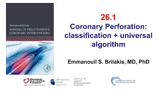 26.1 - Manual of PCI - Perforation overall management