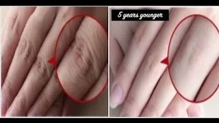 How to Make Your Hands Look 5 Years Younger Overnight! Wrinkle-freesmoothfair hands/sajalareejhacks