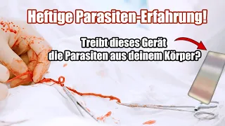 Heftige Parasitenkur-Erfahrung | Massive Parasiten-Ausleitung in kurzer Zeit | Vitori Kristallmatte