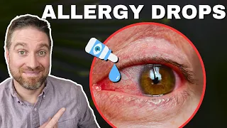 Best Allergy Eye Drops For Red Itchy Eyes! (2024)