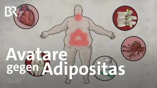 Adipositas: Avatare gegen krankhaftes Übergewicht | Gut zu wissen | BR