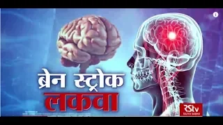 Ayushman Bhava : Brain Stroke | ब्रेन स्ट्रोक (लकवा)