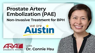 Prostate Artery Embolization - A Non-Invasive Treatment for BPH - ARA Diagnostic Imaging