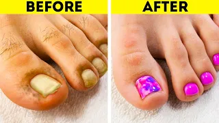 27 Incredible Feet Transformations || Pedicure And Manicure Ideas