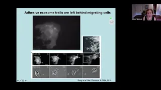 Function of exosome secretion in cancer cell migration and tumor aggressiveness by Alissa Weaver