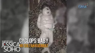 Kapuso Mo, Jessica Soho: Cyclops baby