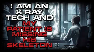 Sci-Fi Horror Story "One of my patients is missing his skeleton" | Creepypasta Narration