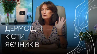 Дермоїдні кісти яєчників | Людмила Шупенюк