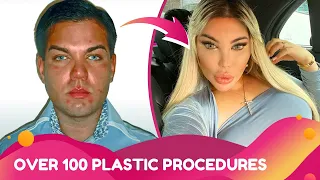 Shocking Plastic Surgery Transformations — Part 1 | Rumour Juice