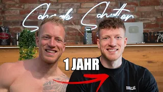 1 Jahr nach der Haartransplantation! Habe viel falsch gemacht.