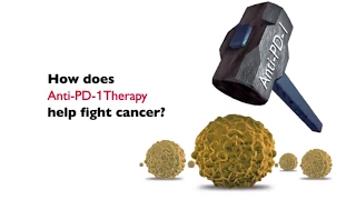 How Does Anti-PD-1 Therapy Help Fight Cancer?