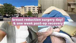 breast reduction surgery day! | first week post-op breast reduction recovery