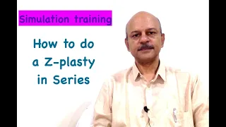 #zplasty What is Z plasty in series - How to do it?