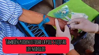 Cómo canalizar Fácil - Instalación de venoclisis - Terapia de infusión intravenosa ‼️ 🤓📝💉