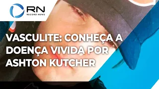 Vasculite: conheça doença que deixou Ashton Kutcher sem enxergar, falar e andar