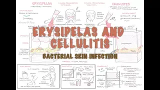 Bacterial Skin Infection - Cellulitis and Erysipelas (Clinical Presentation, Pathology, Treatment)