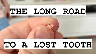 PULLING FIRST LOOSE TOOTH | The Long Road to a Lost Tooth.