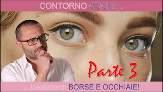 Contorno occhi, inestetismi: borse e occhiaie!