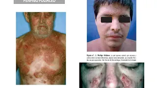 Tmmed dermatología - 4