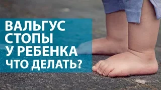 Вальгус стопы у ребенка! Что делать? ОН КЛИНИК Бейби