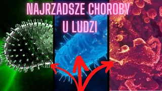 Najrzadsze choroby na świecie u ludzi #shorts