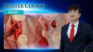 [Master Course - BASIC] Understanding and Configuring Implant Prostheses 2