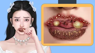 ASMR Worm & Maggot Lips Infected | Deep Cleaning Animation