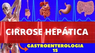 CIRROSE HEPÁTICA (CAUSAS, SINTOMAS, DIAGNÓSTICO E TRATAMENTO) - GASTROENTEROLOGIA