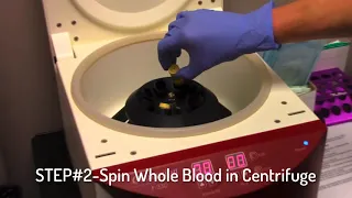 Platelet Rich Plasma PRP Preparation (to some cool music)