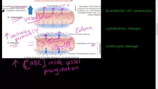 #19 - Acute Inflammation 1 of 3 - Vascular permeability, Vasodilation