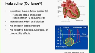 New Options for Advanced Heart Failure: Drugs and Devices by Michael Zacharias, DO