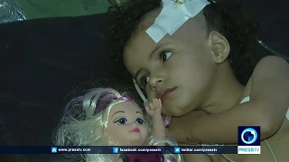 Yemeni Children Suffer From Diphtheria As War Continues