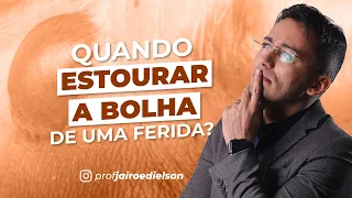 Quando estourar a bolha de uma ferida?