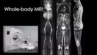 Imaging of Bone tumors I jordan Aug 2014   Dr Mamdouh Mahfouz In Arabic